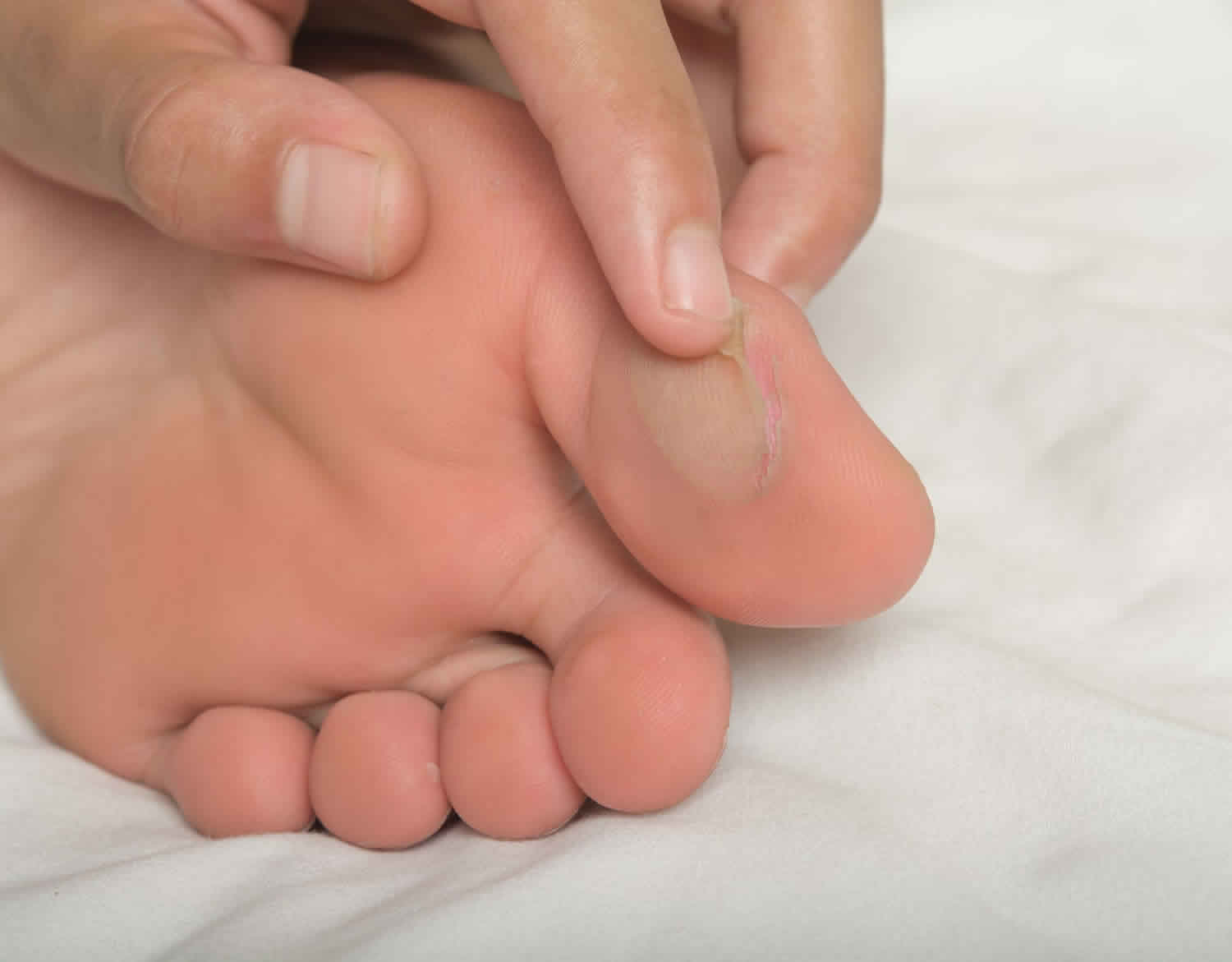 What are blisters & What are the Conditions that cause blisters?