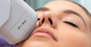 HIFU – Non-Surgical Treatment for Facial Skin Tightening
